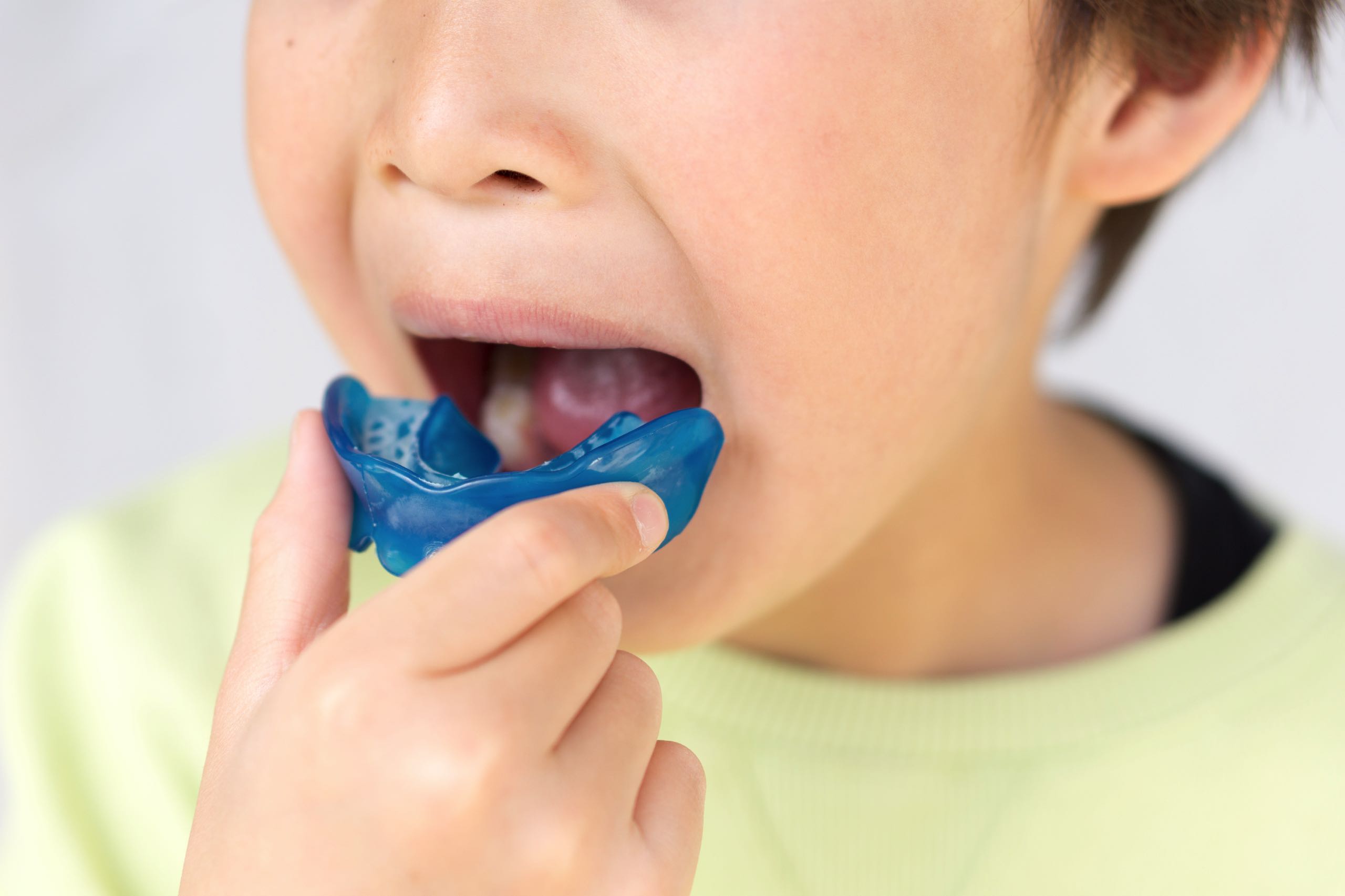 Ortodonzia Miofunzionale