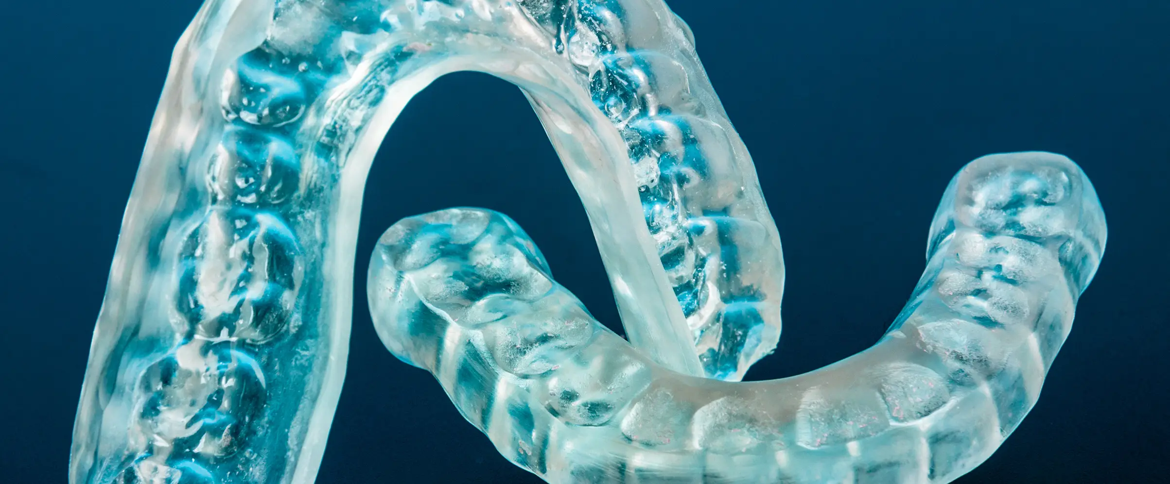Bite Dentale: Quando è necessario?