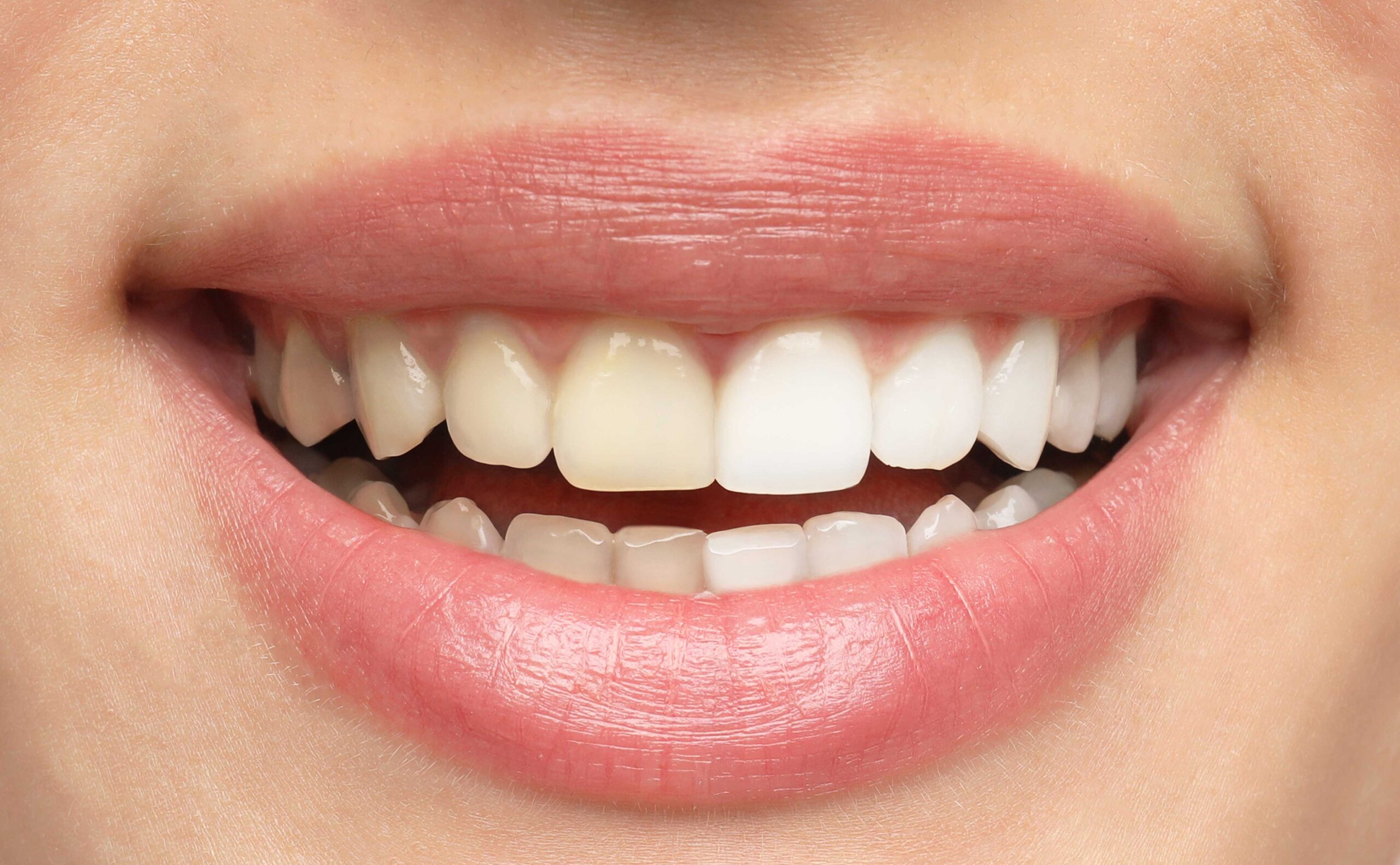 Cibi che macchiano i denti