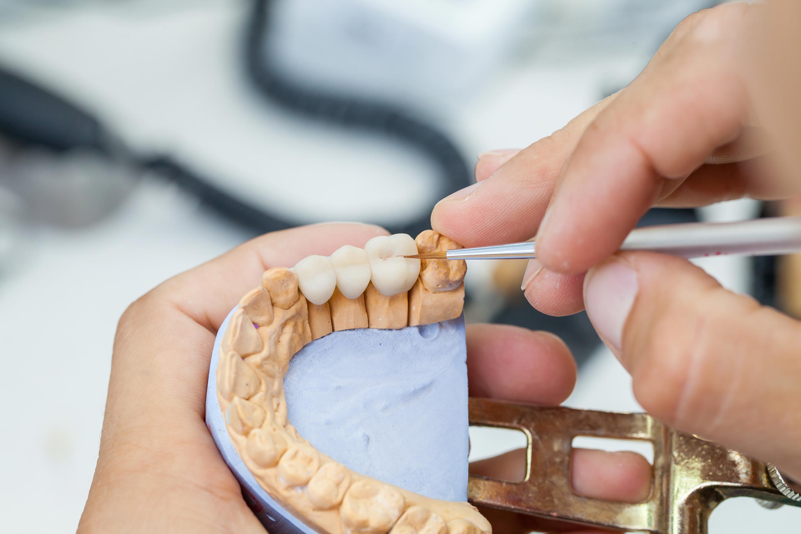 Corona in Ceramica